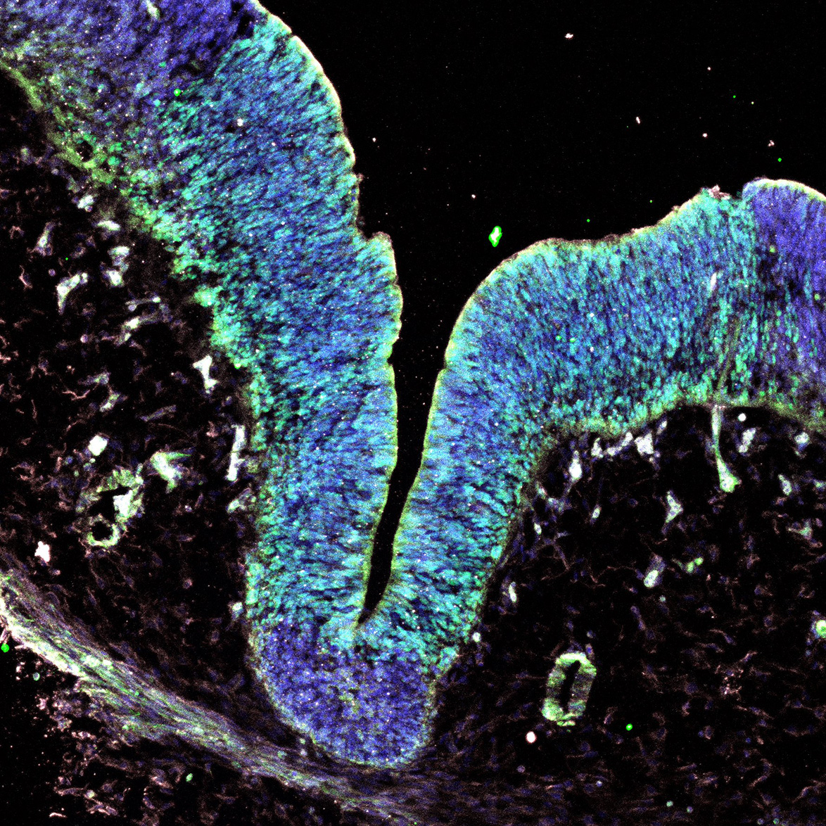 Human foetal midbrain
