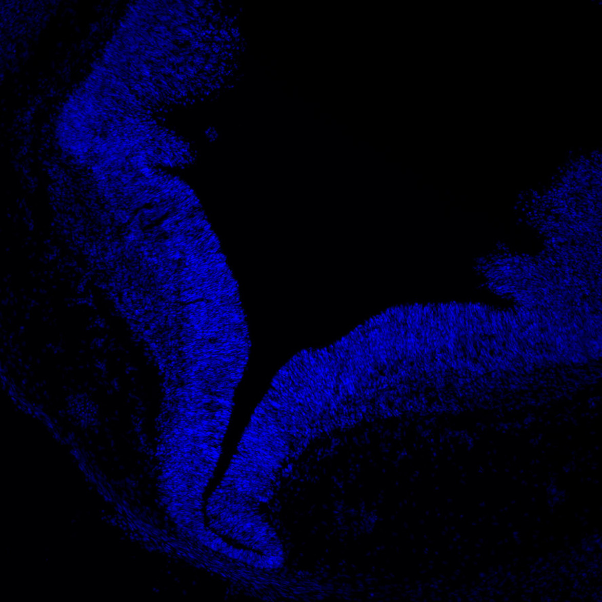 Human foetal midbrain