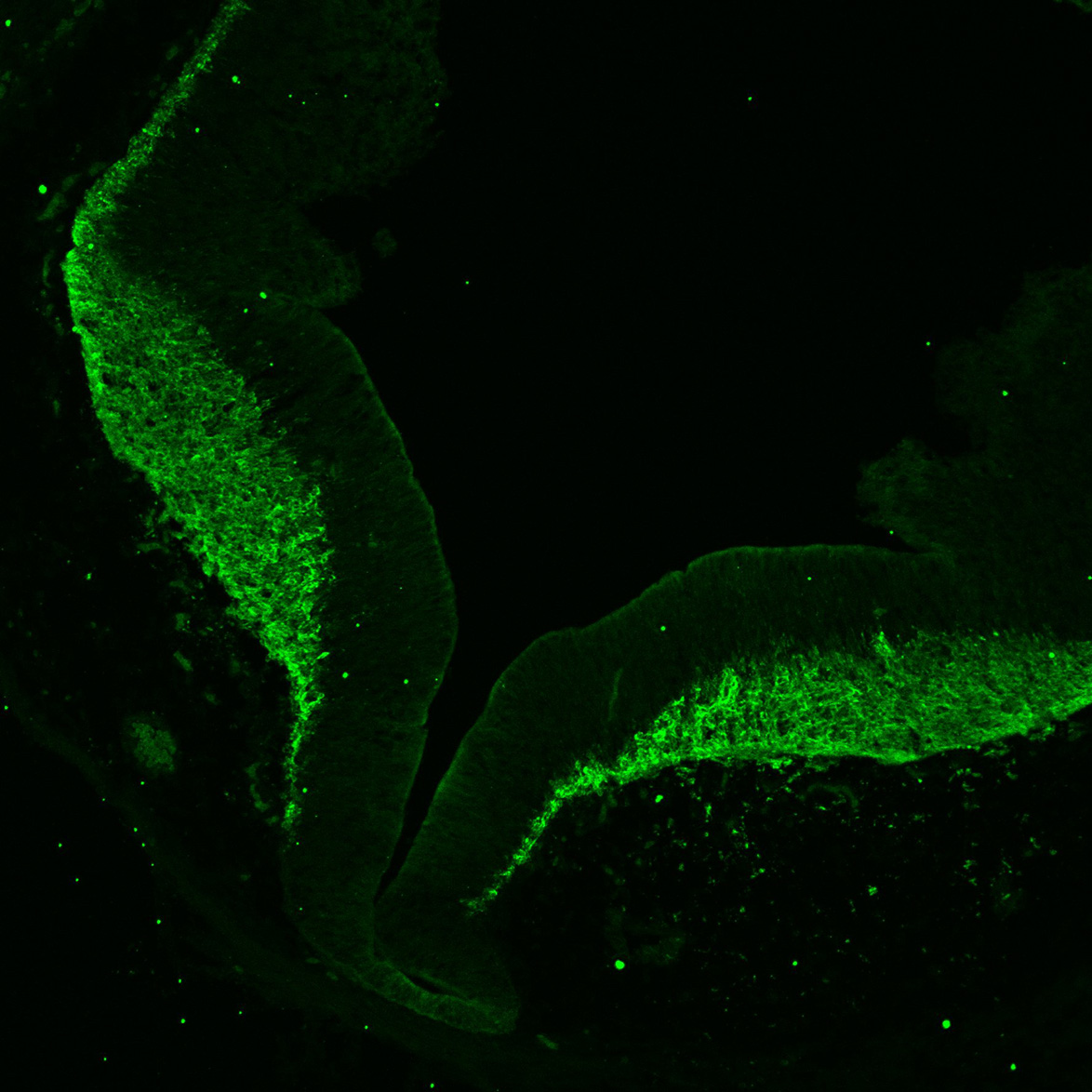 Human foetal midbrain