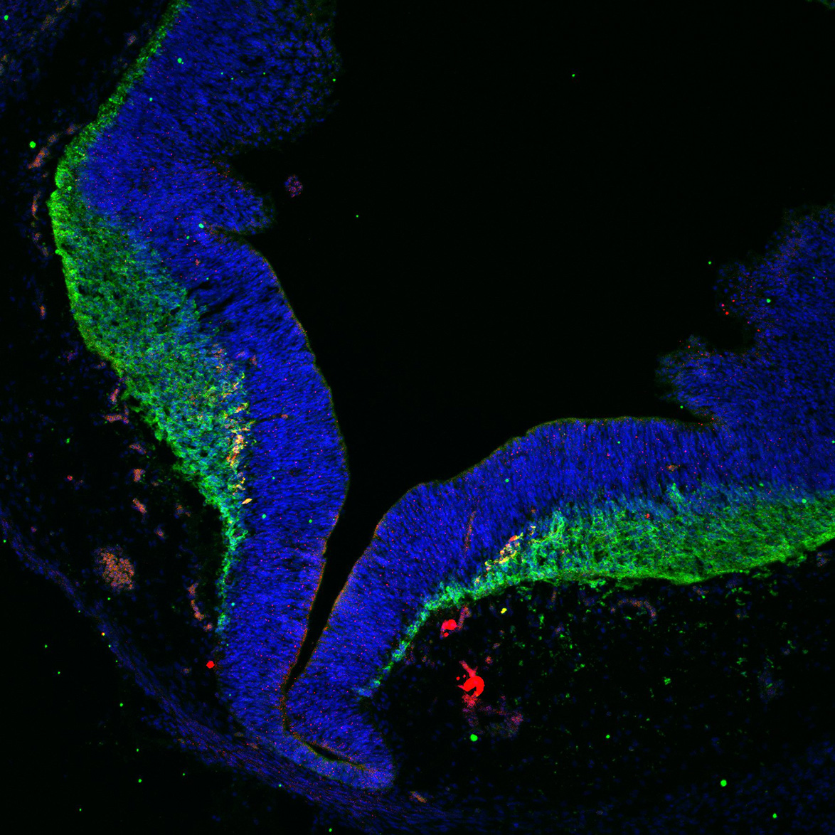 Human foetal midbrain