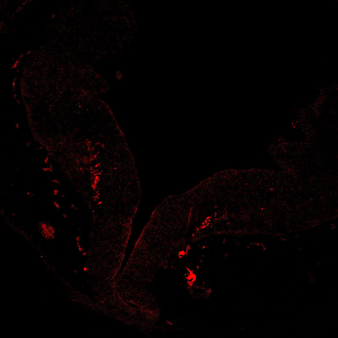 Human foetal midbrain