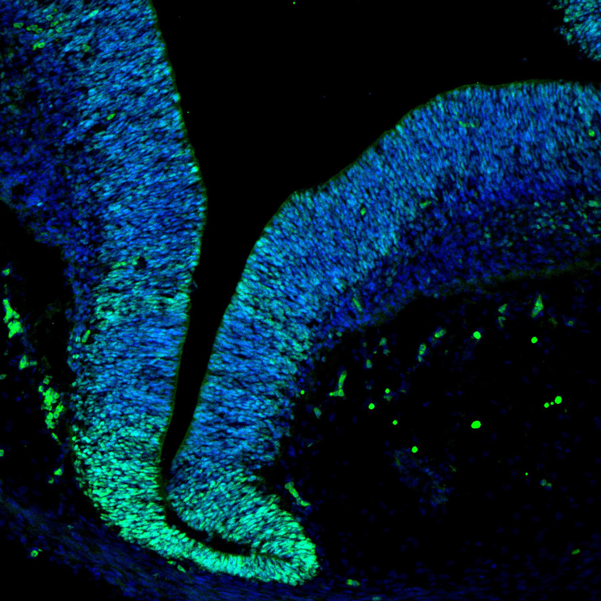 Human foetal midbrain