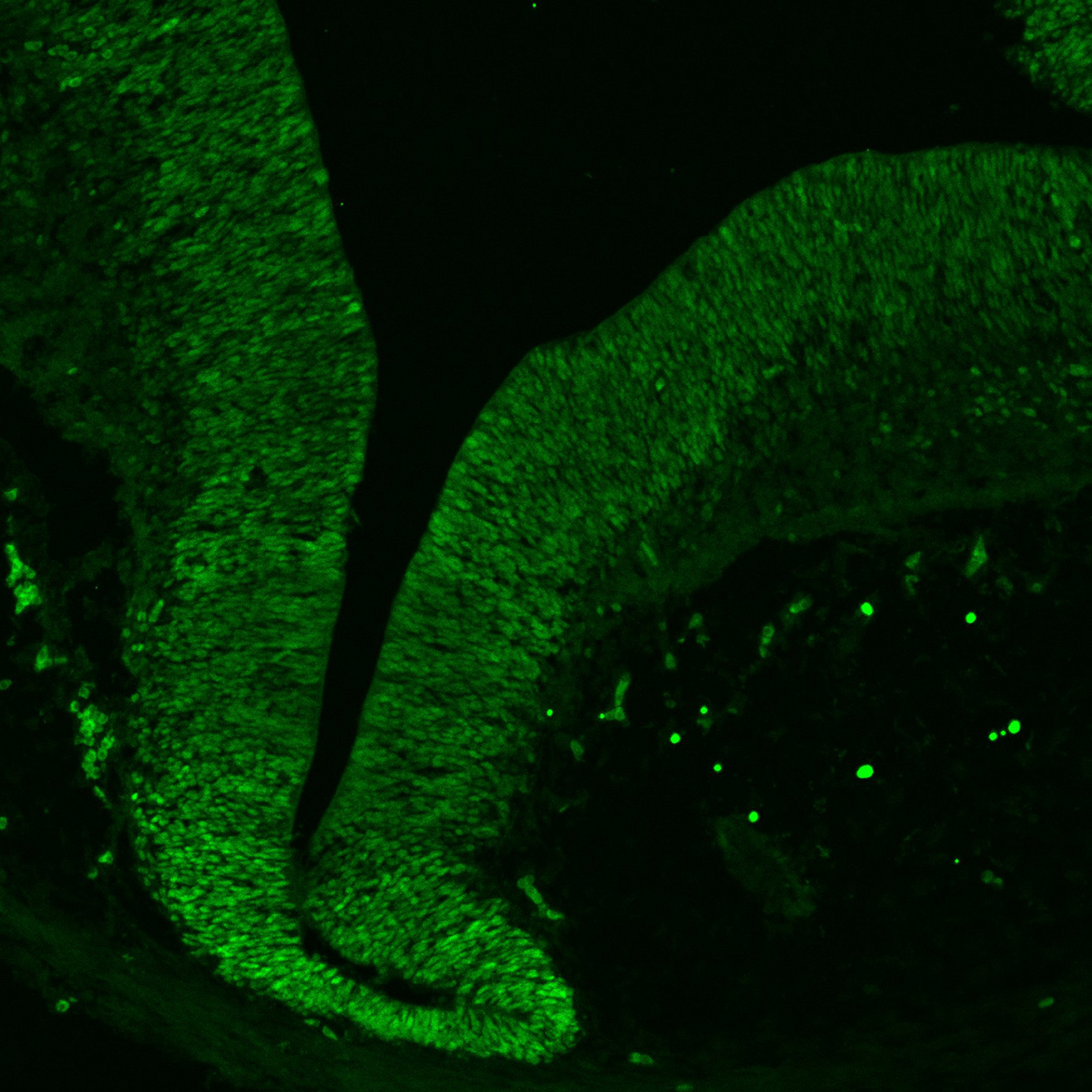 Human foetal midbrain