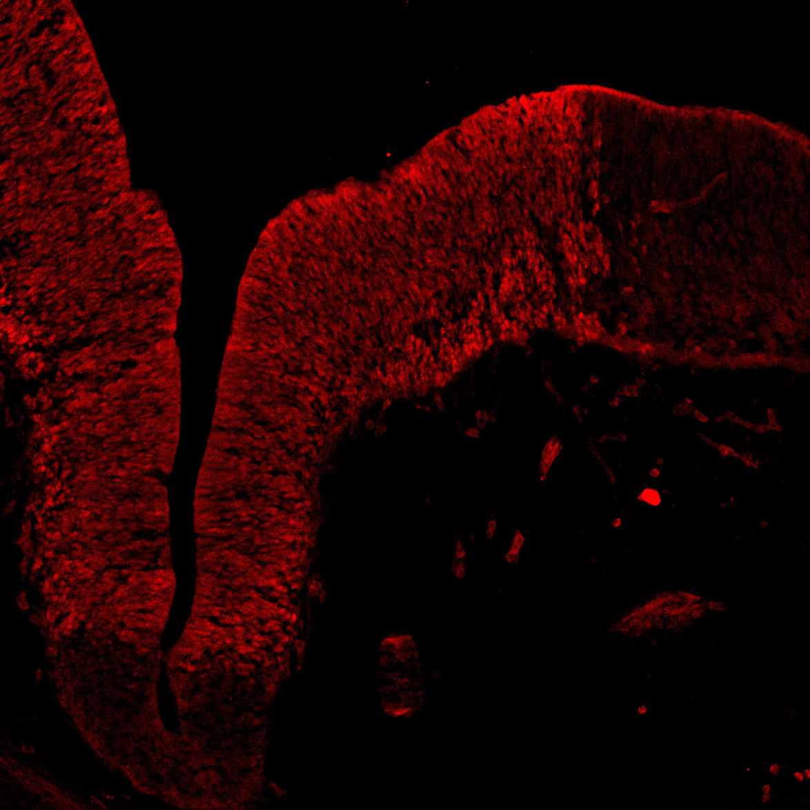 Human foetal midbrain