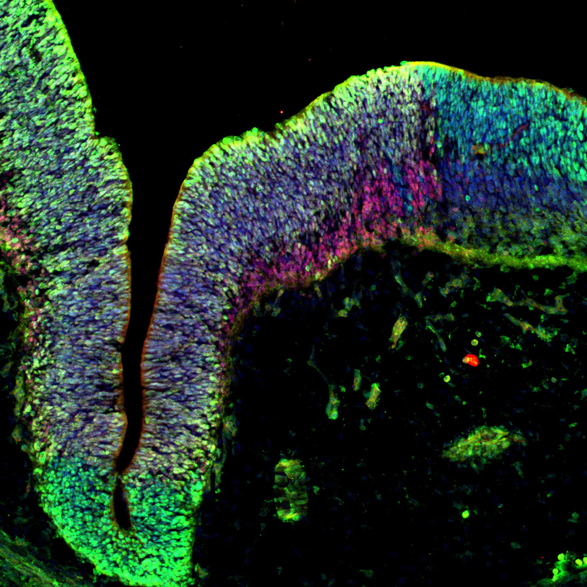 Human foetal midbrain