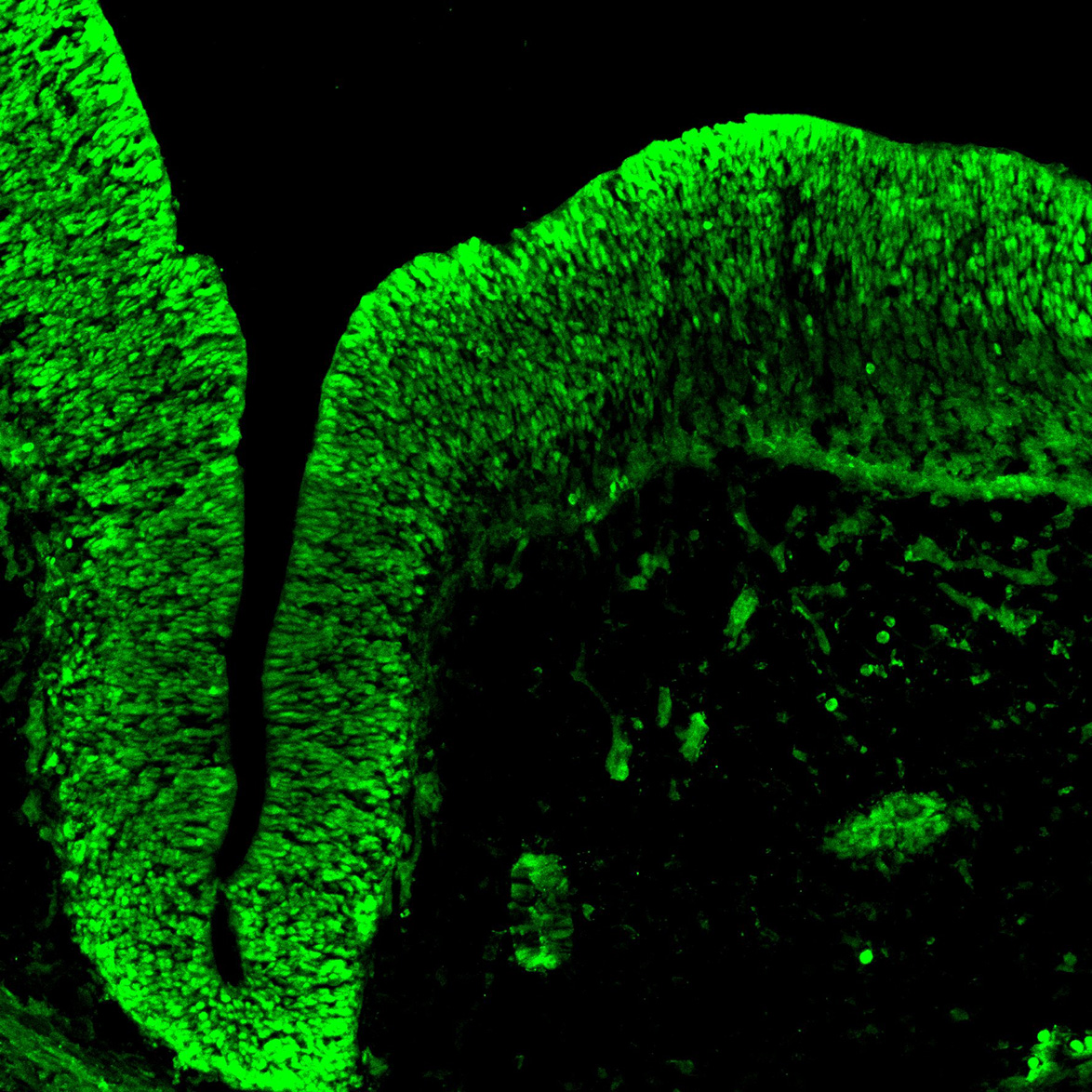 Human foetal midbrain