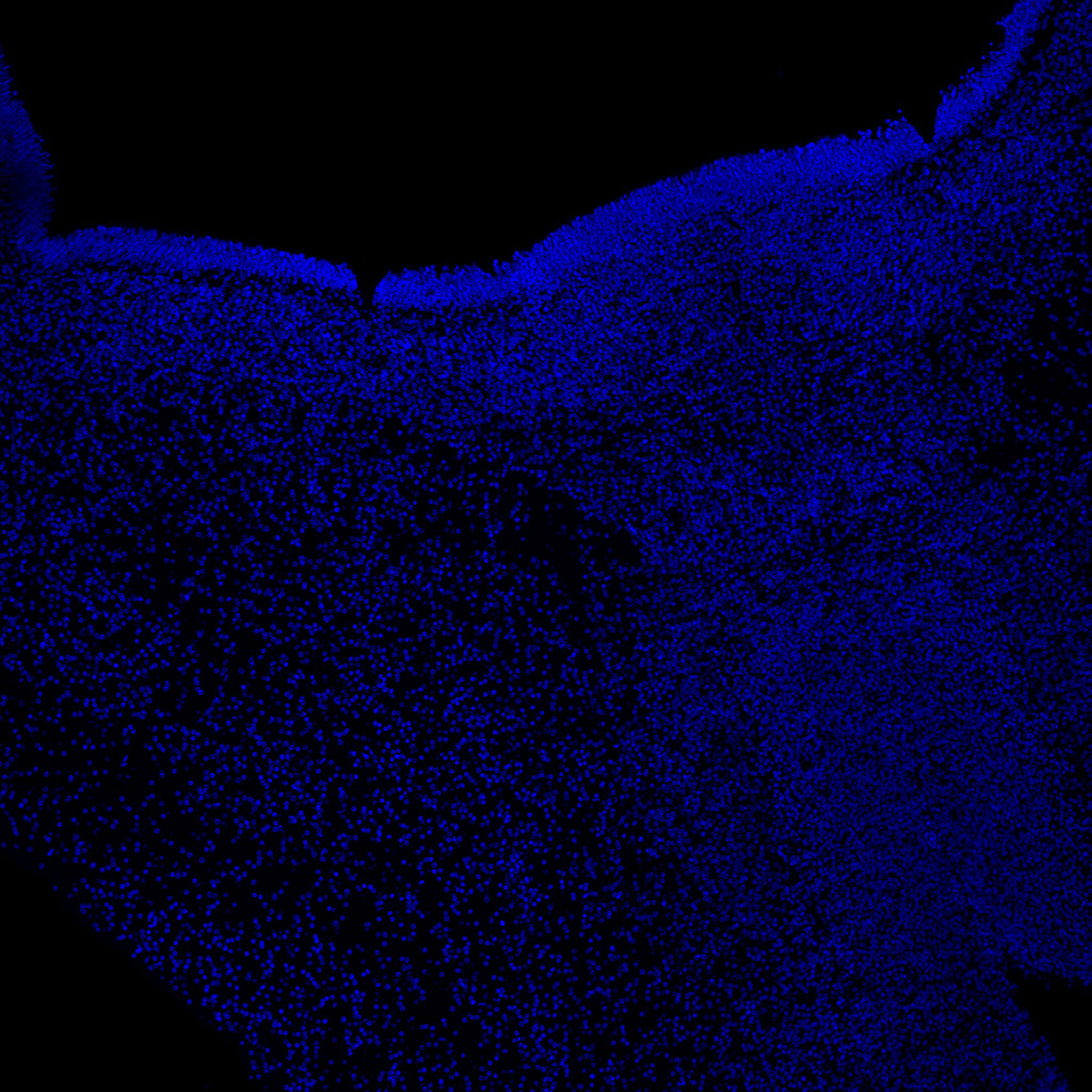 Human foetal midbrain