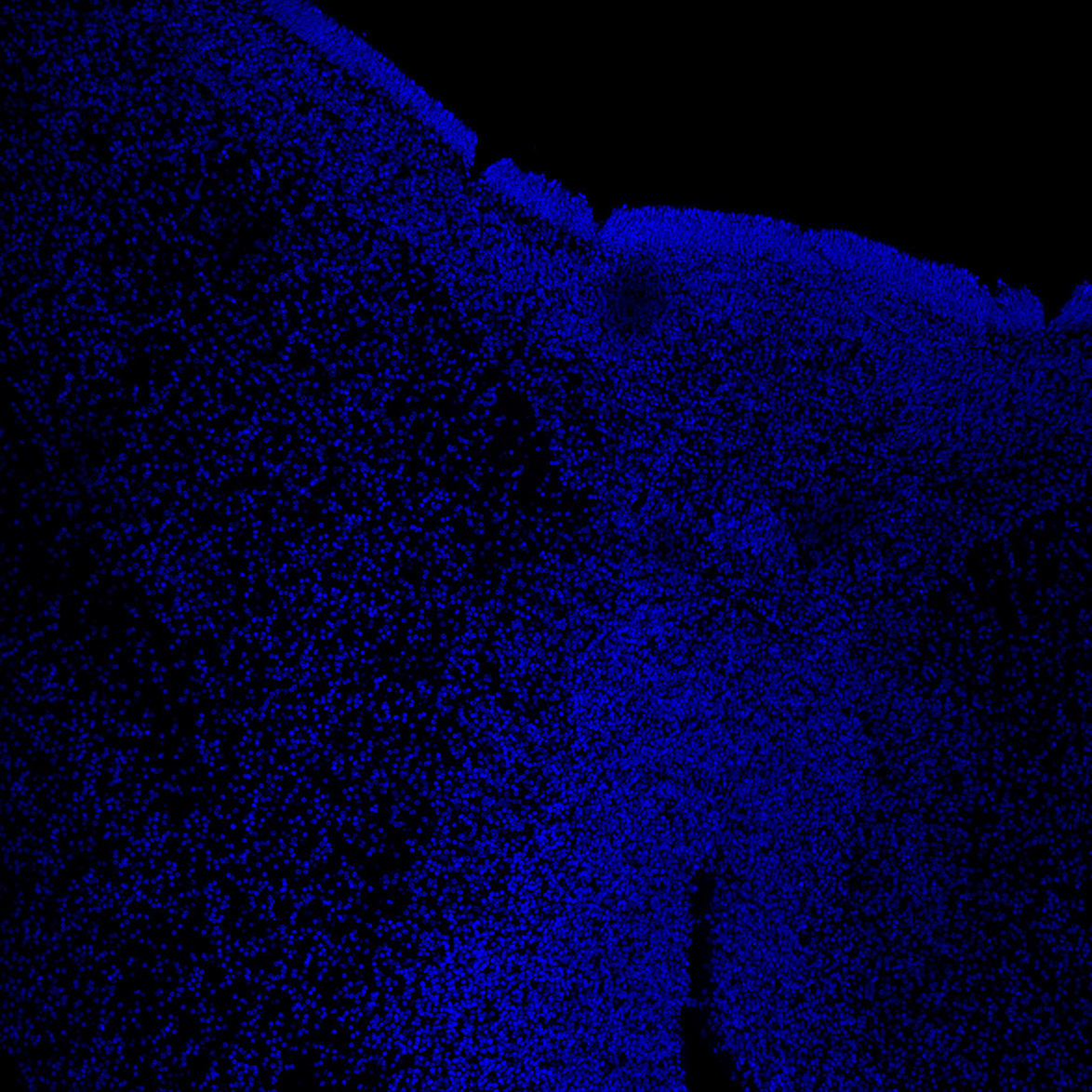 Human foetal midbrain