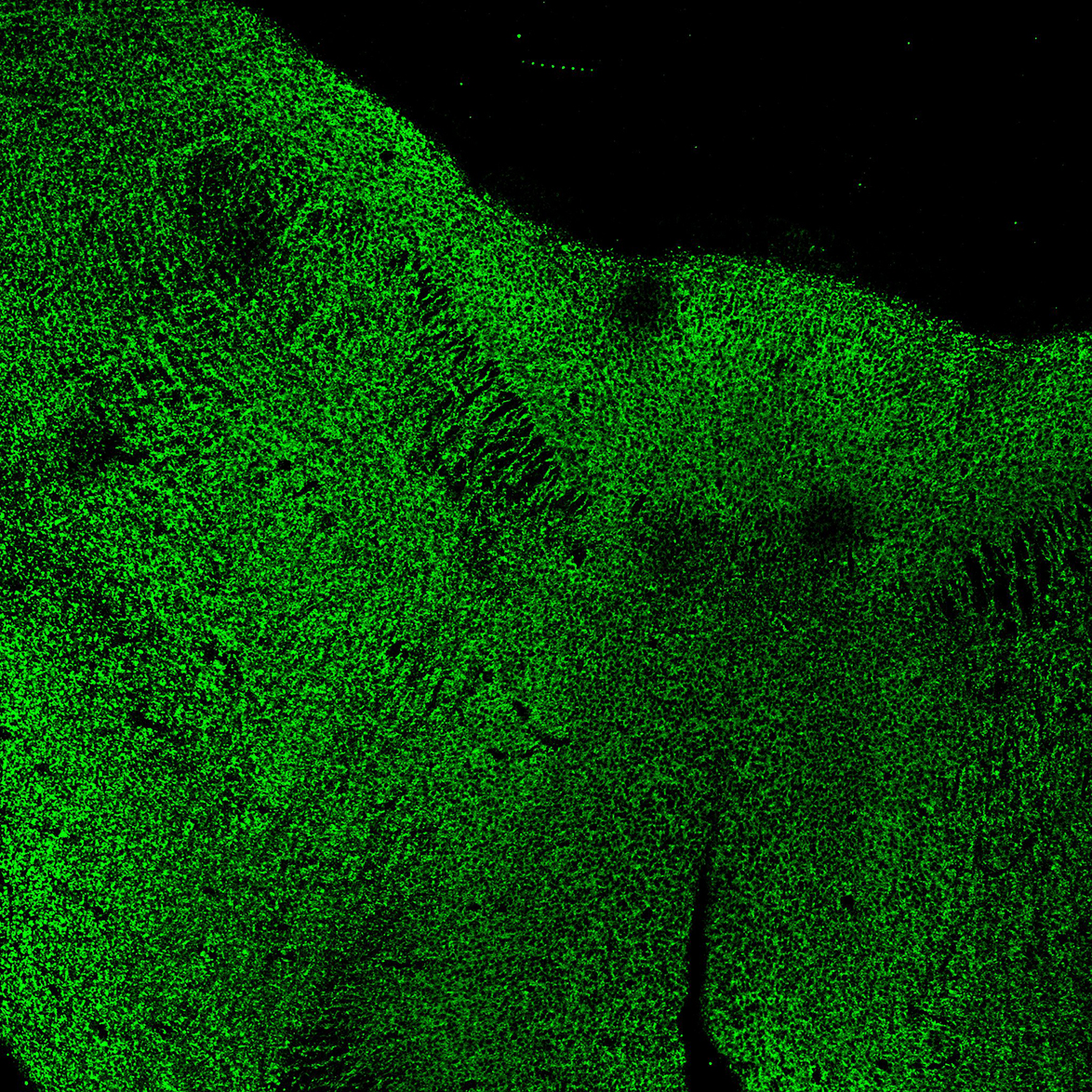 Human foetal midbrain