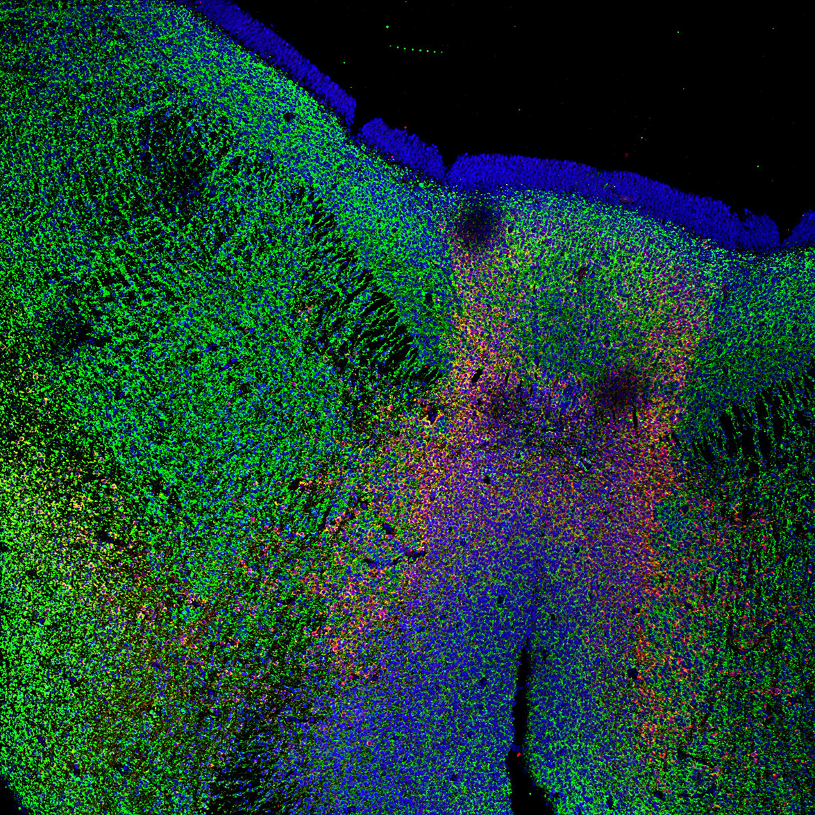 Human foetal midbrain