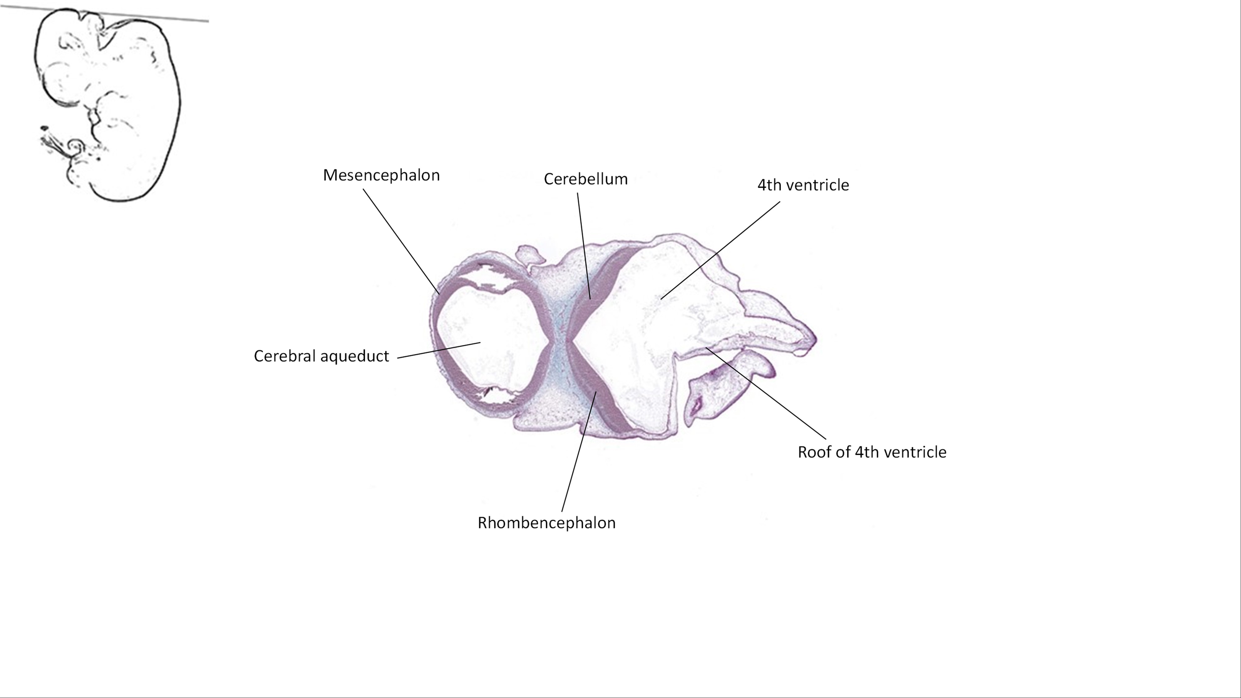 A histology section of a human embryo