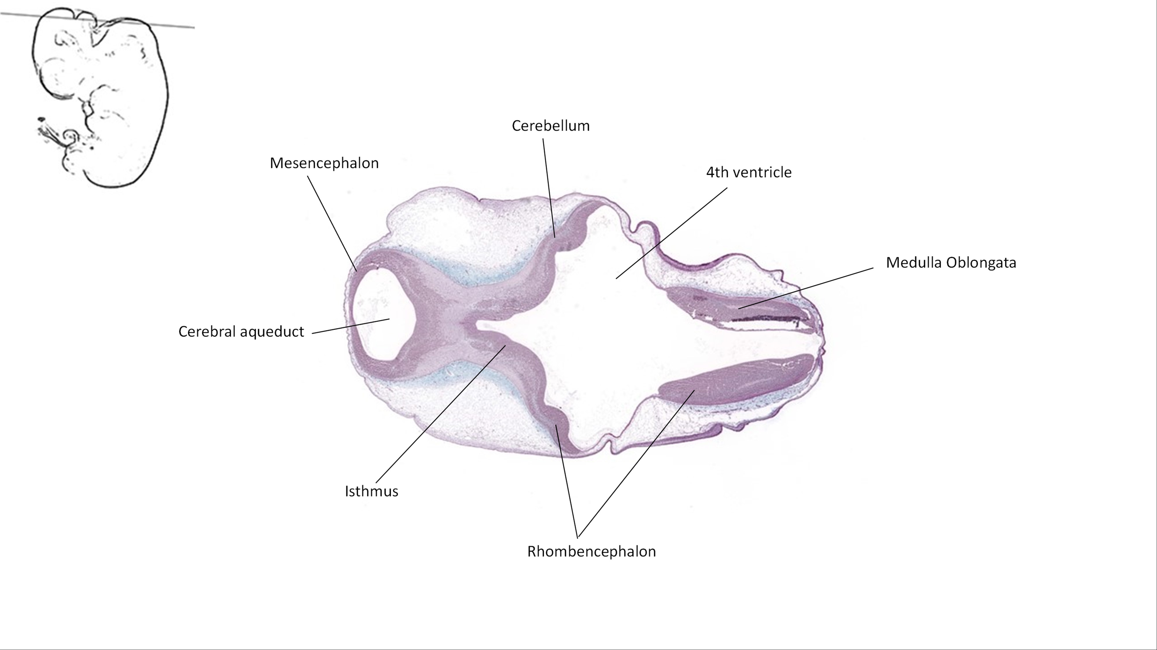 A histology section of a human embryo