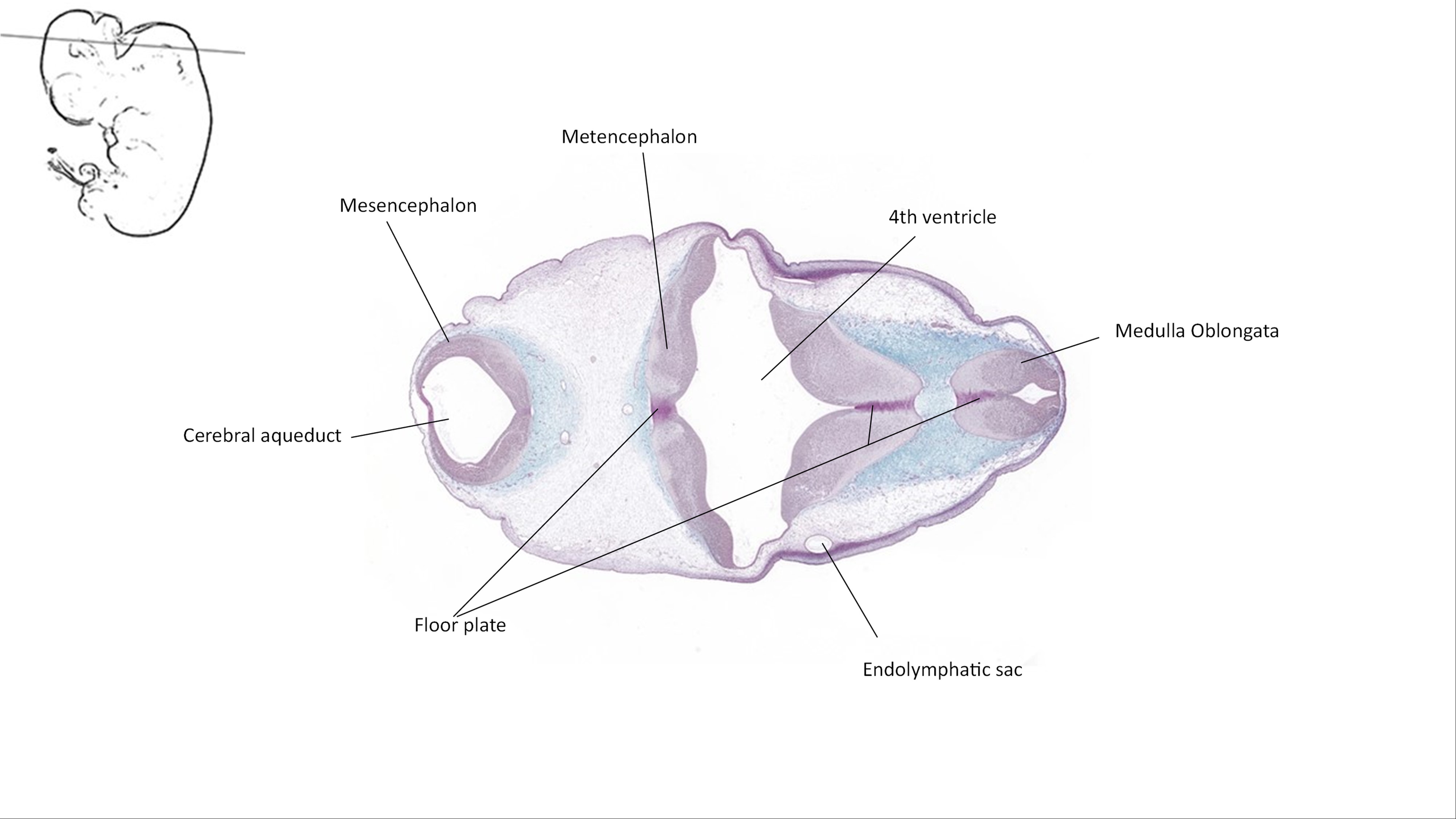 A histology section of a human embryo