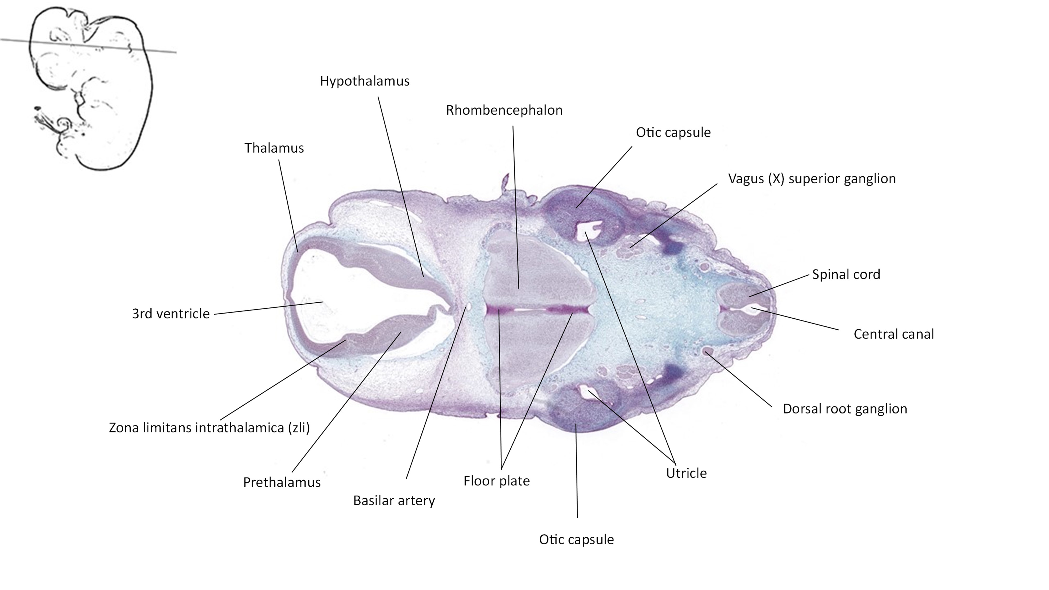 A histology section of a human embryo