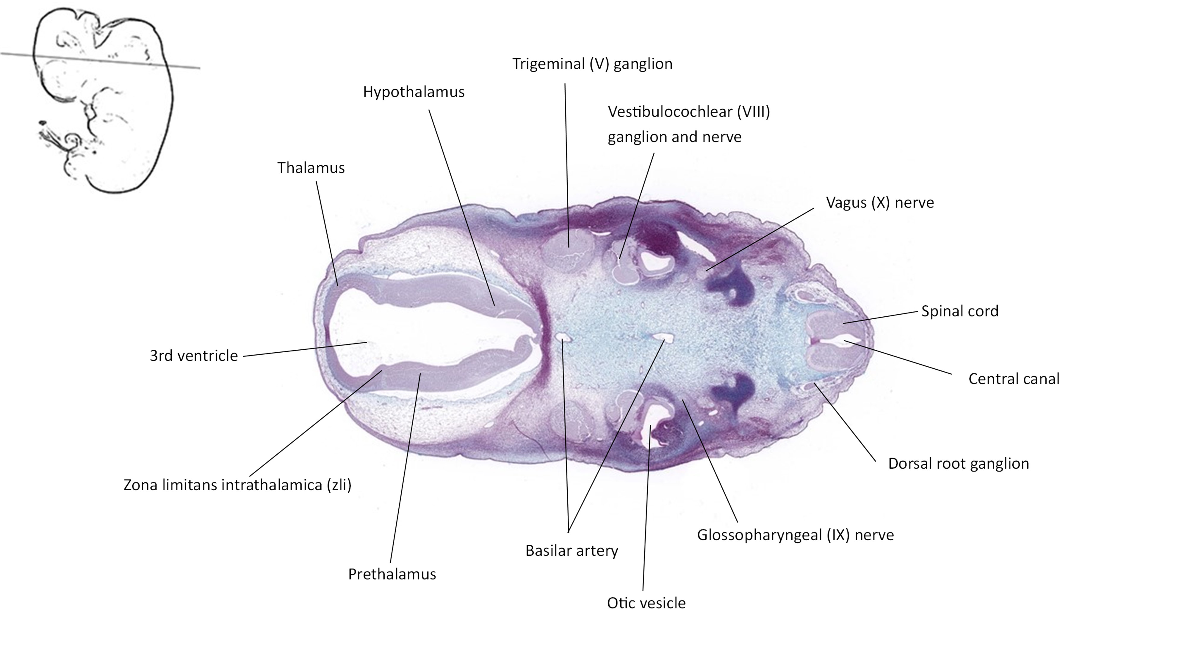 A histology section of a human embryo