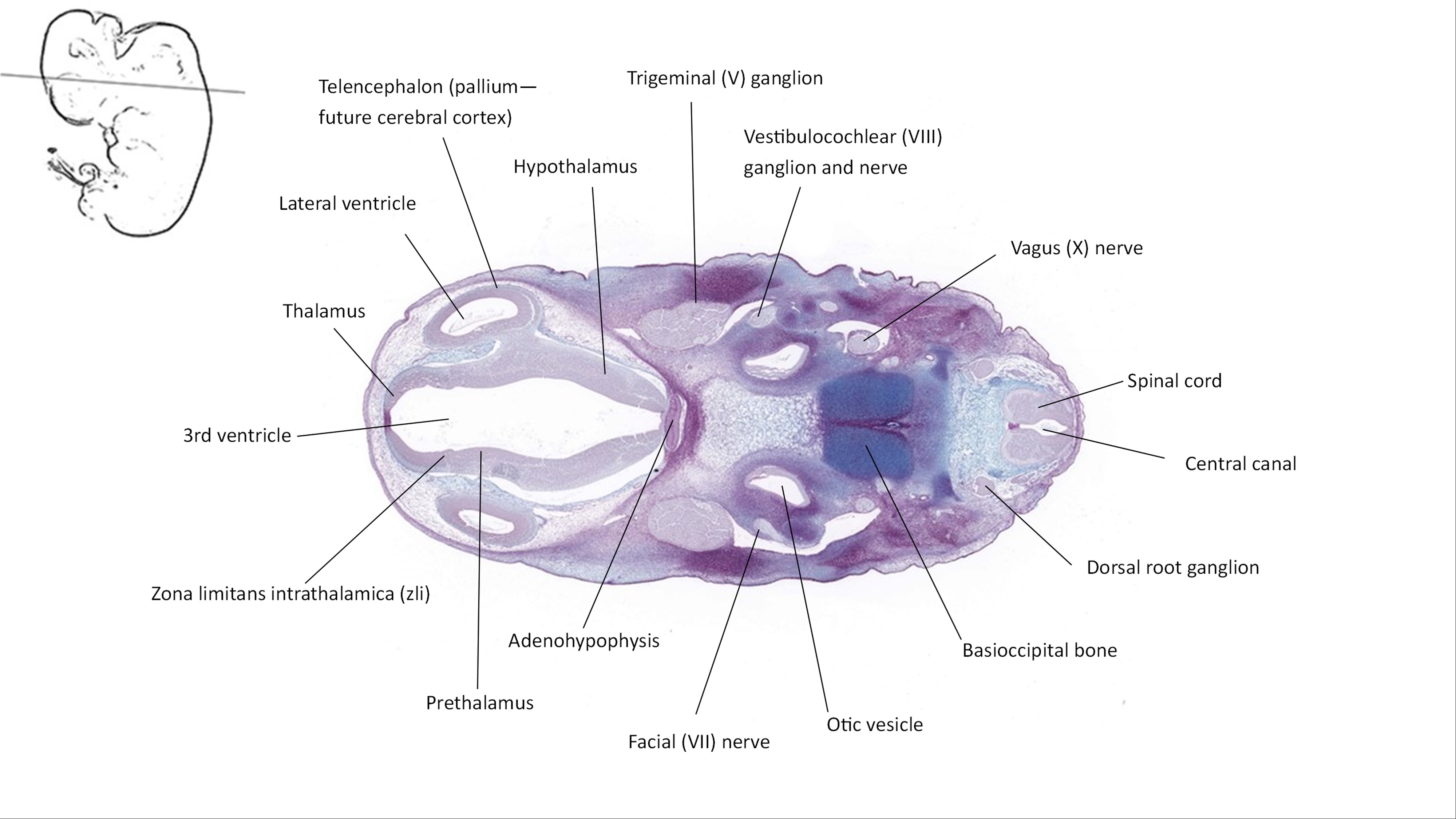 A histology section of a human embryo