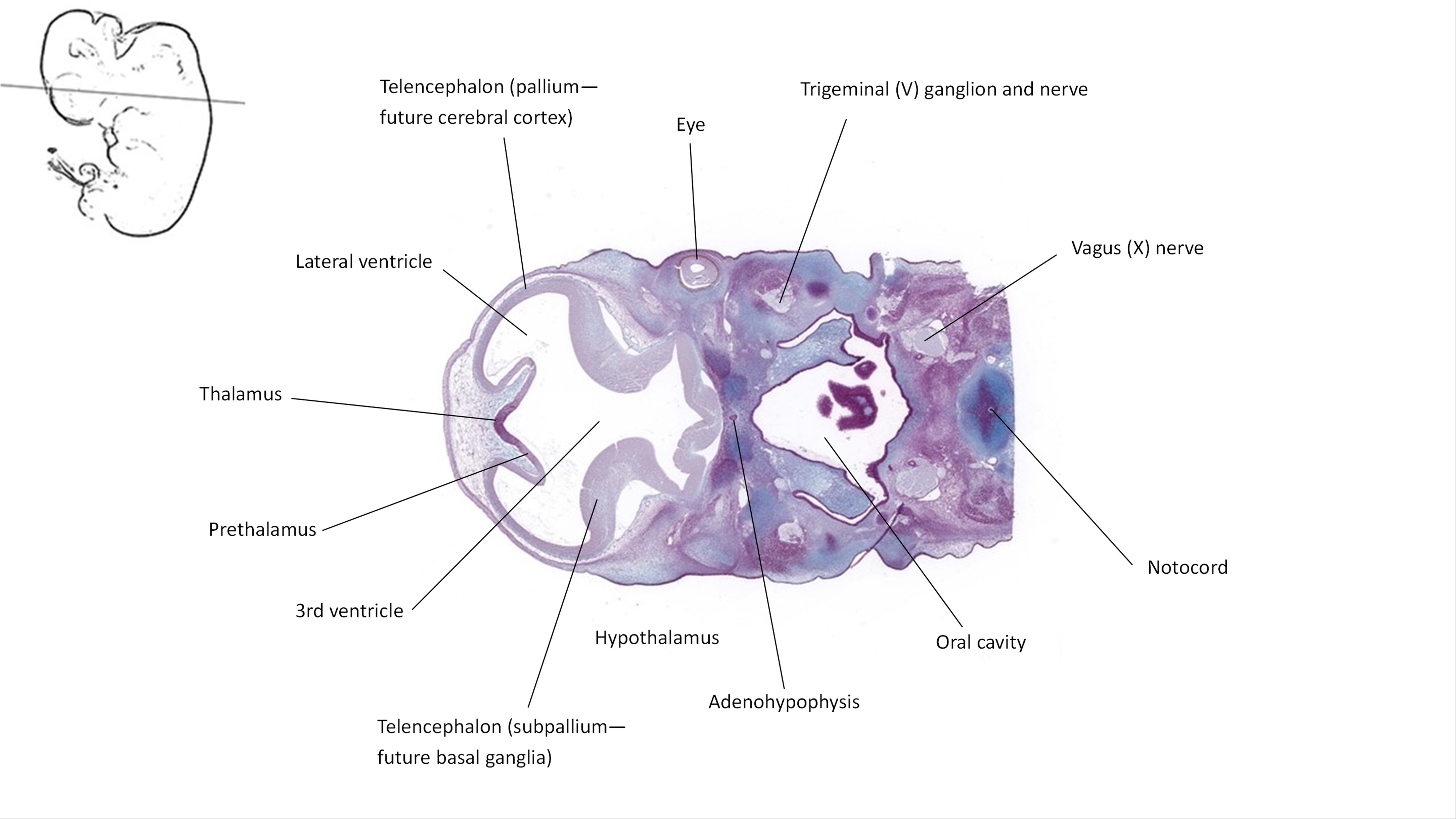 A histology section of a human embryo