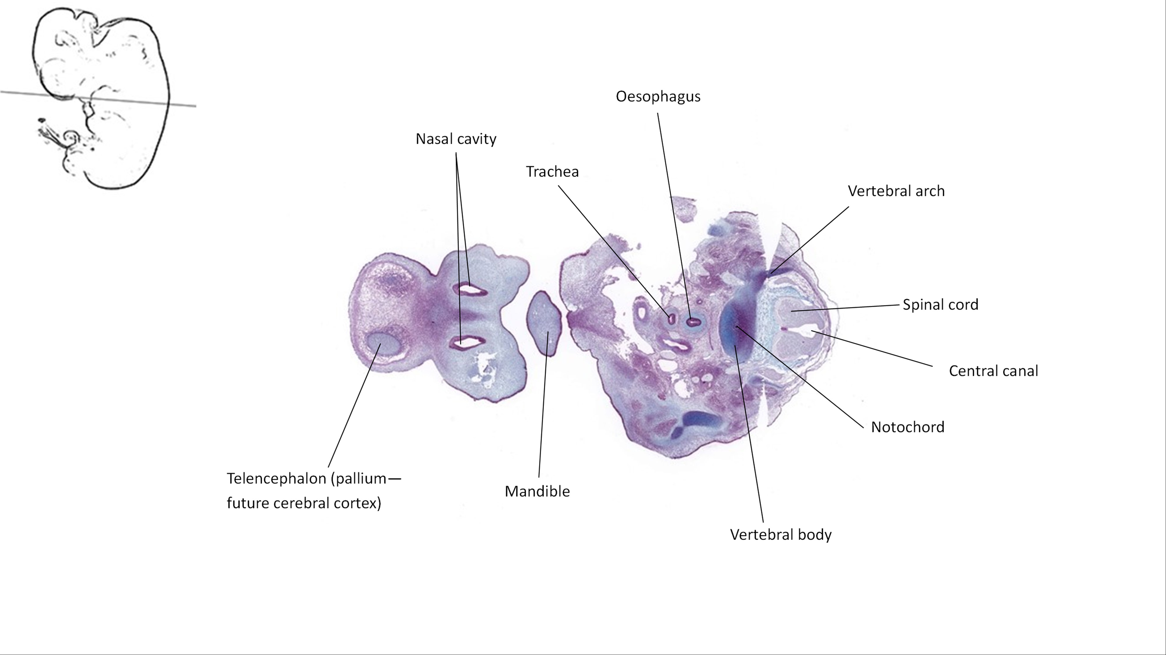 A histology section of a human embryo