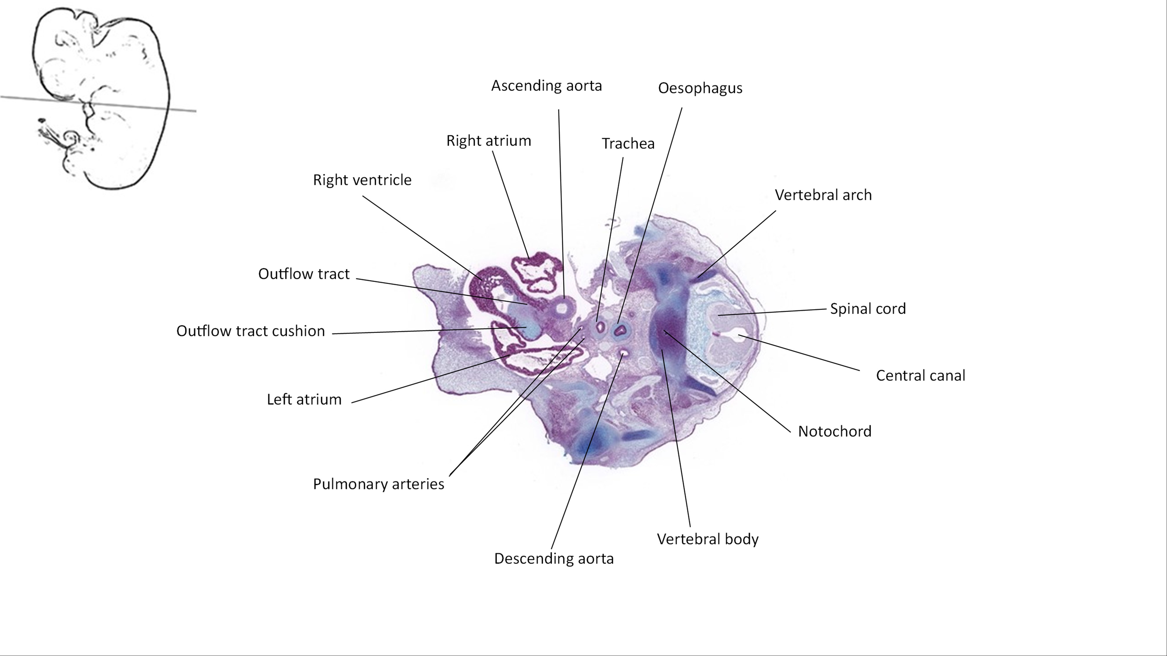 A histology section of a human embryo