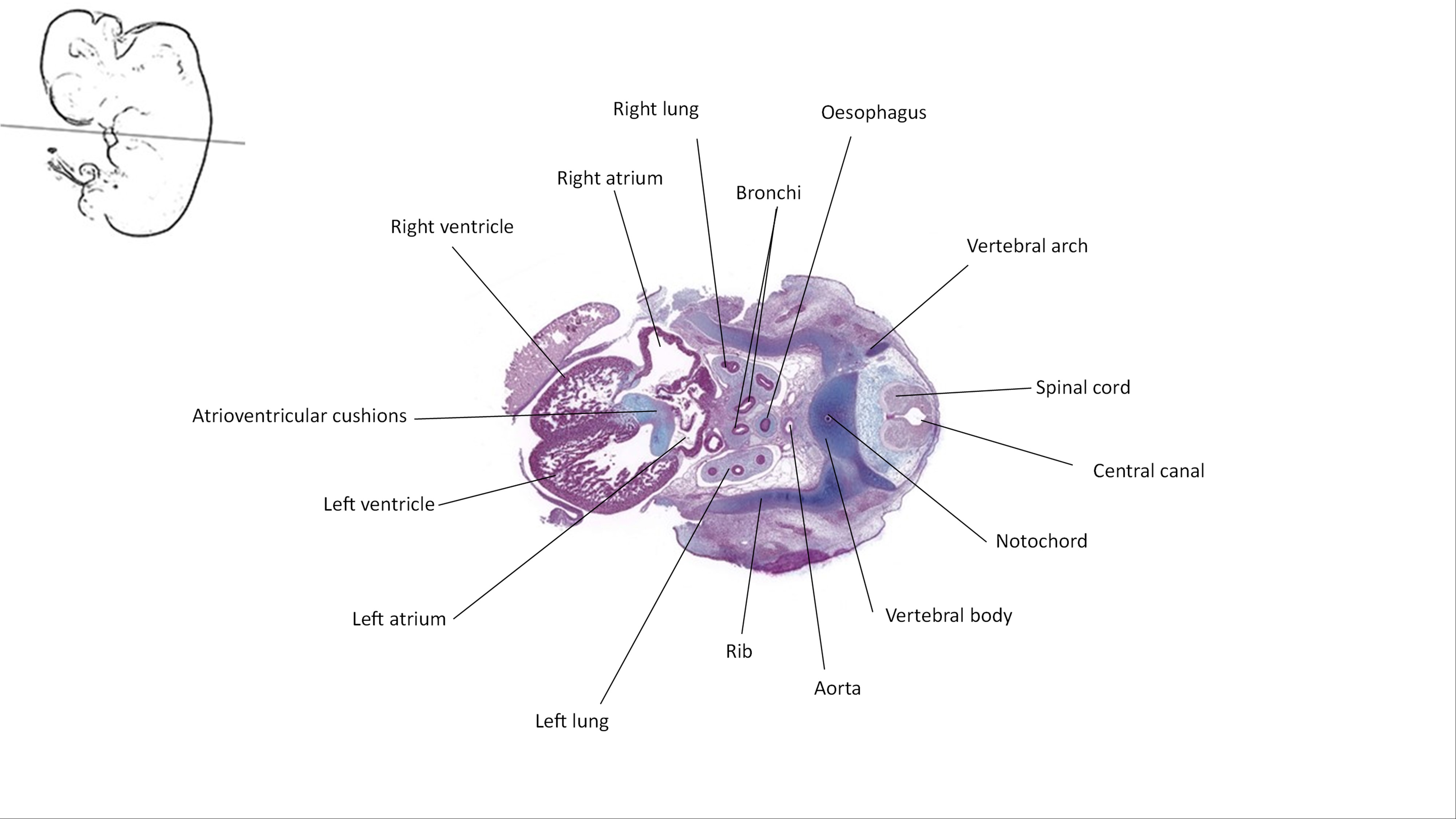 A histology section of a human embryo