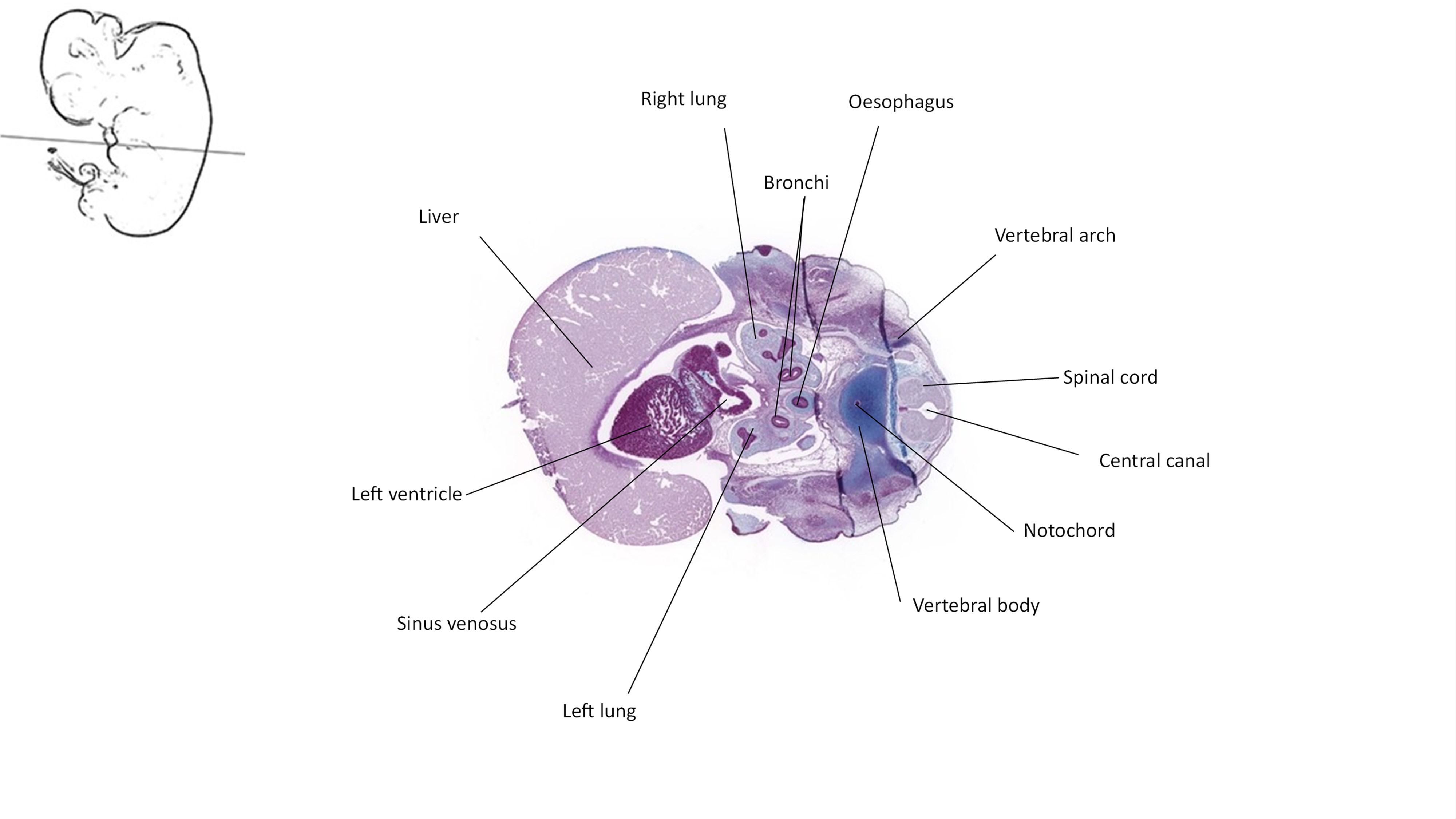 A histology section of a human embryo