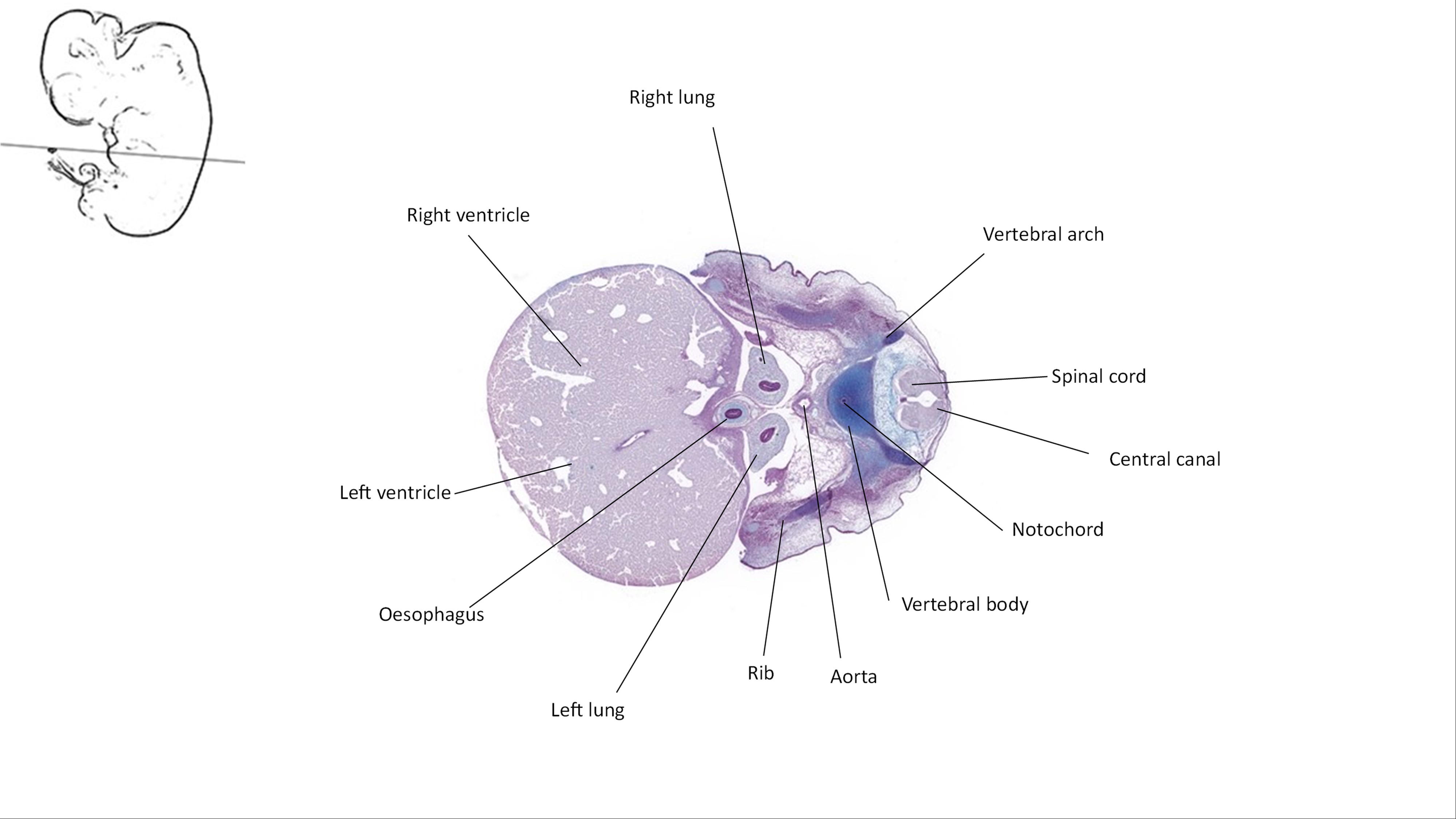 A histology section of a human embryo