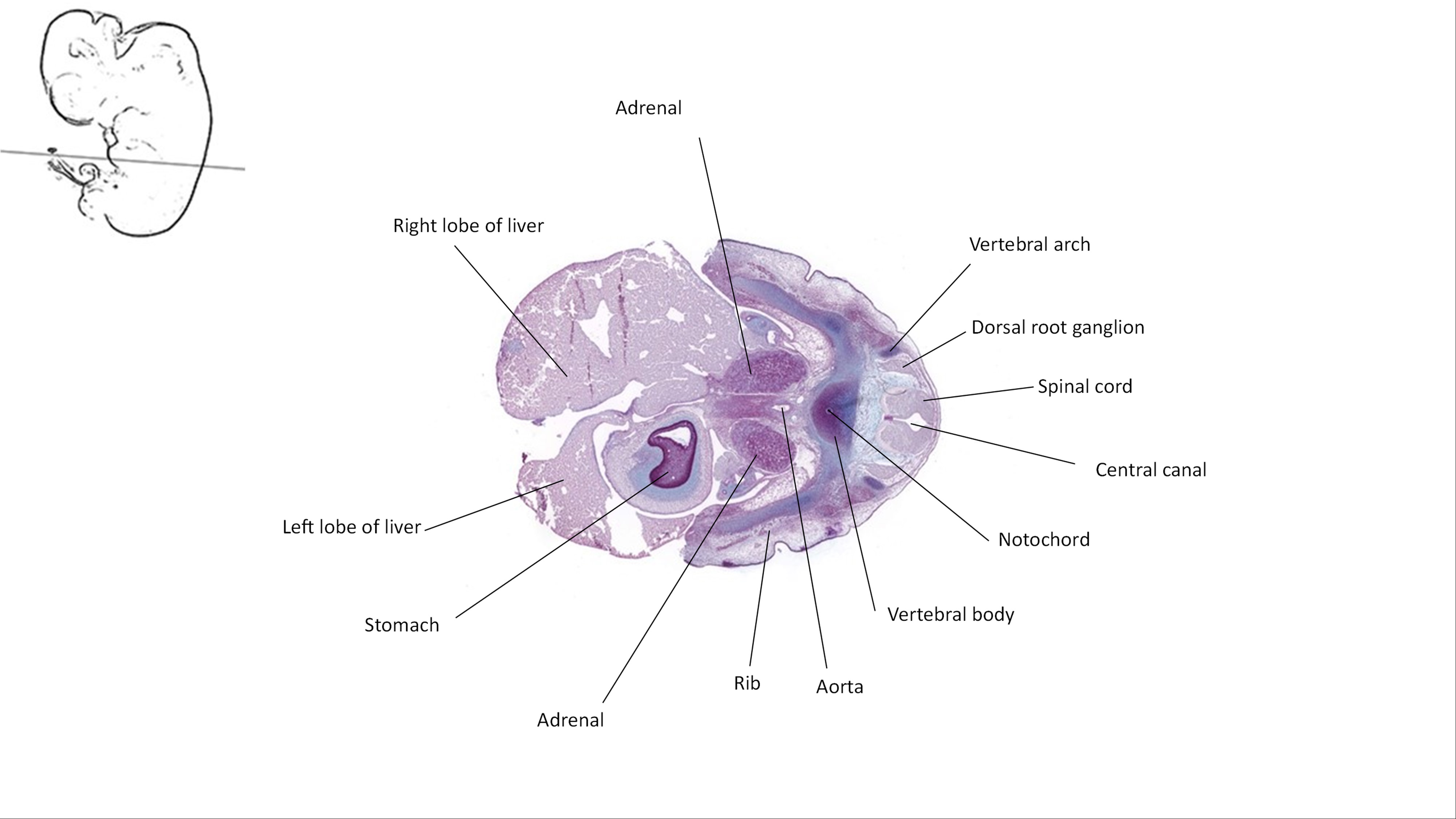 A histology section of a human embryo