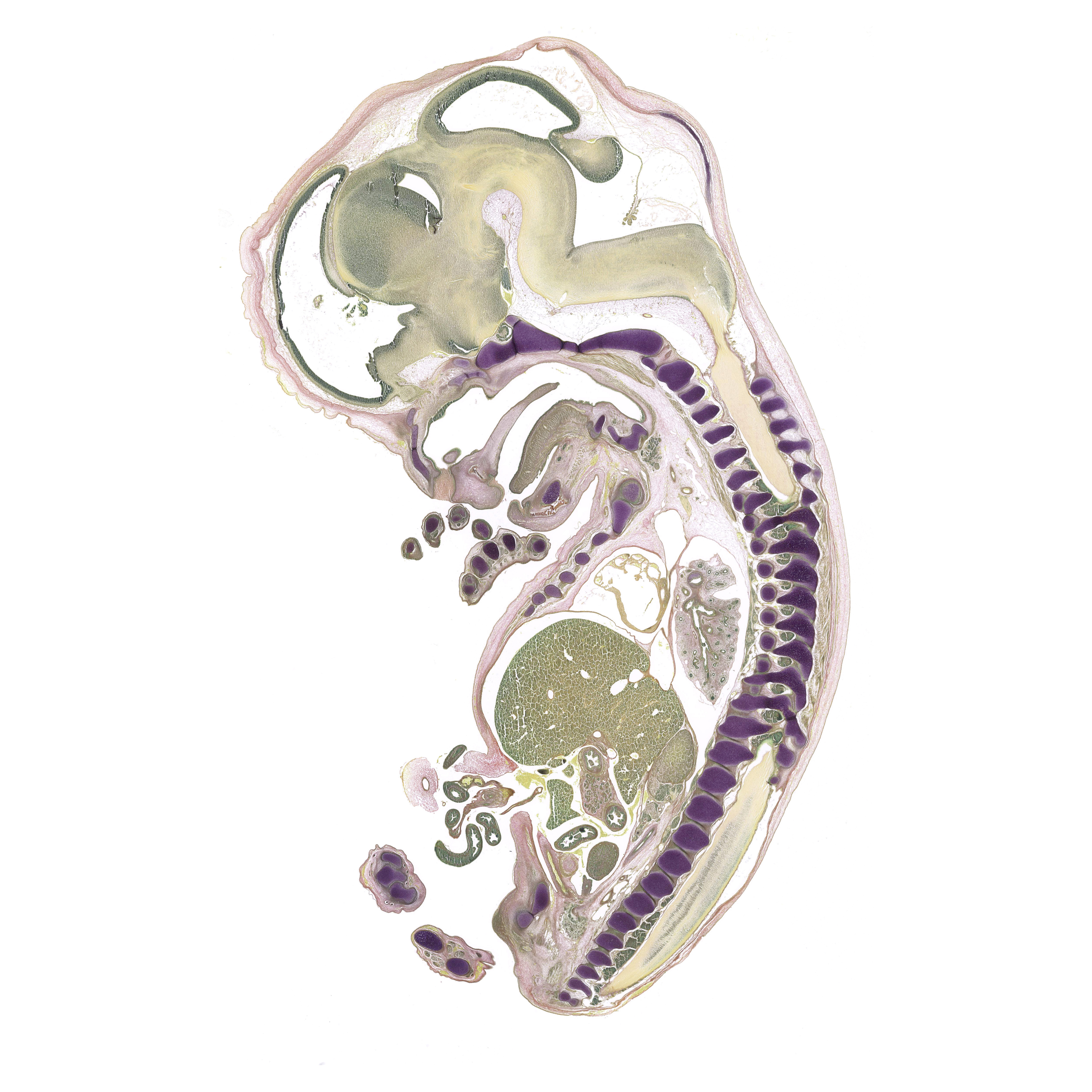 A pentachrome stained section of a human embryo