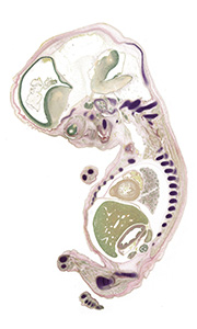 A pentachrome stained section of a human embryo