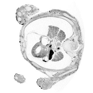 10 post-conception week fetal histology section