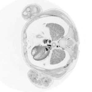 11 post-conception week fetal histology section