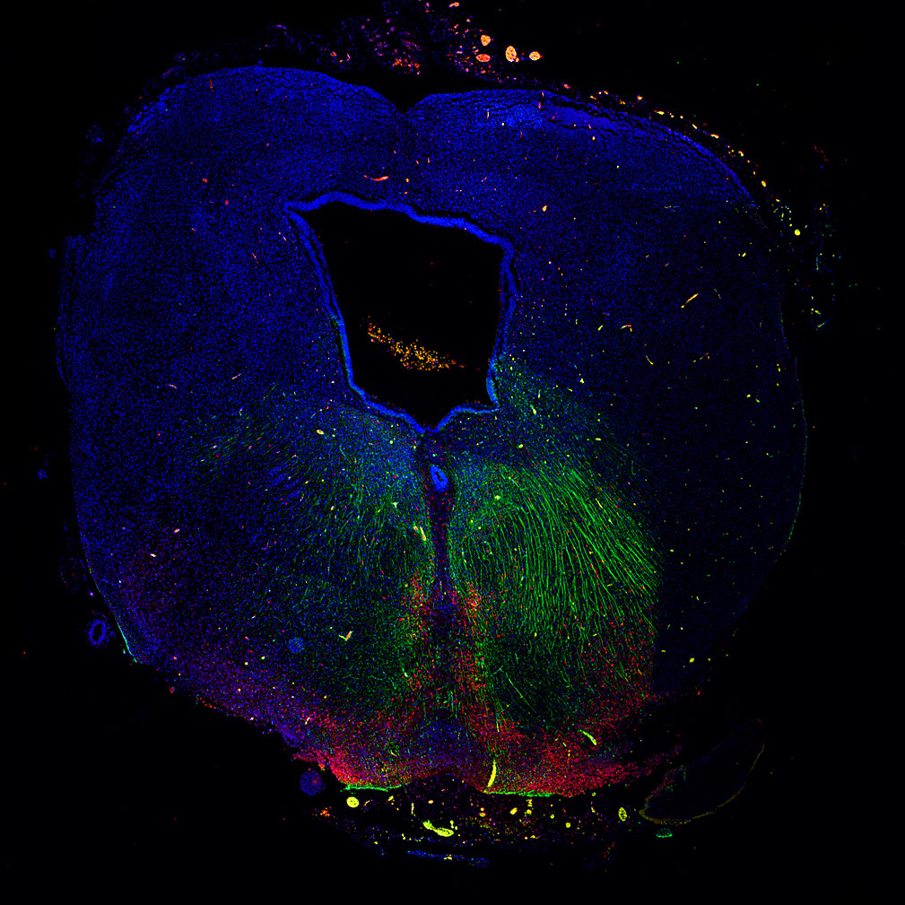 Section of a human embryonic brain