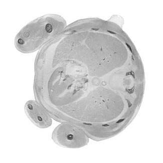 14 post-conception week fetal histology section