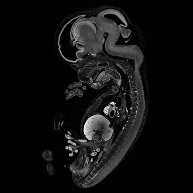A CT scan of a human fetus 8 post conception weeks