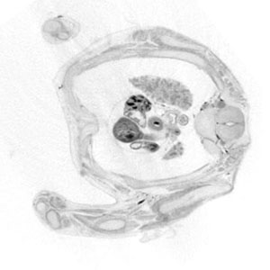 Late 8 post-conception week fetal histology section