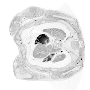 9 post-conception week fetal histology section