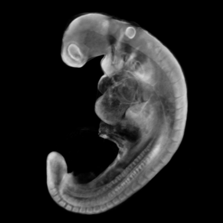human embryo 3D model