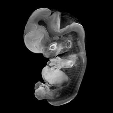 A human embryo at carnegie stage 9