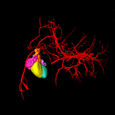 3D model of a human embryonic heart