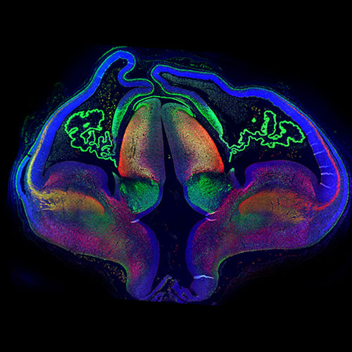 Section of a human embryonic brain