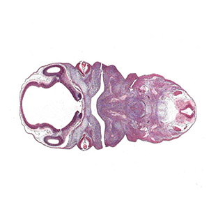 a histology section of a human embryo