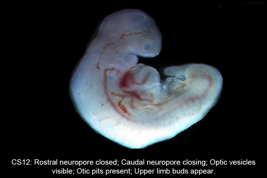 A human embryo, Carnegie Stage 12