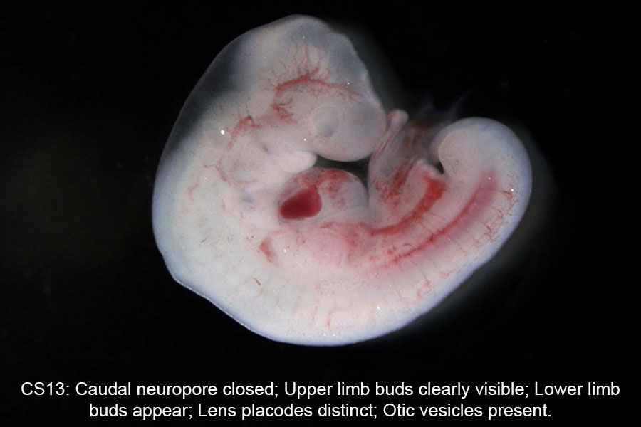 A human embryo, Carnegie Stage 13