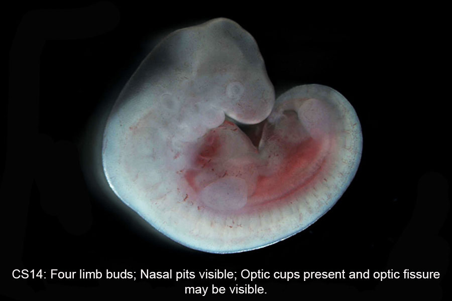 A human embryo, Carnegie Stage 14