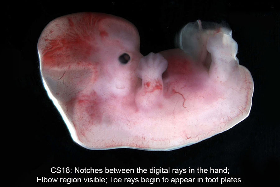 A human embryo, Carnegie Stage 18