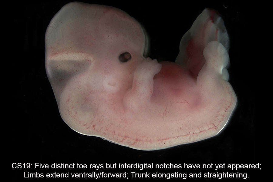 A human embryo, Carnegie Stage 19
