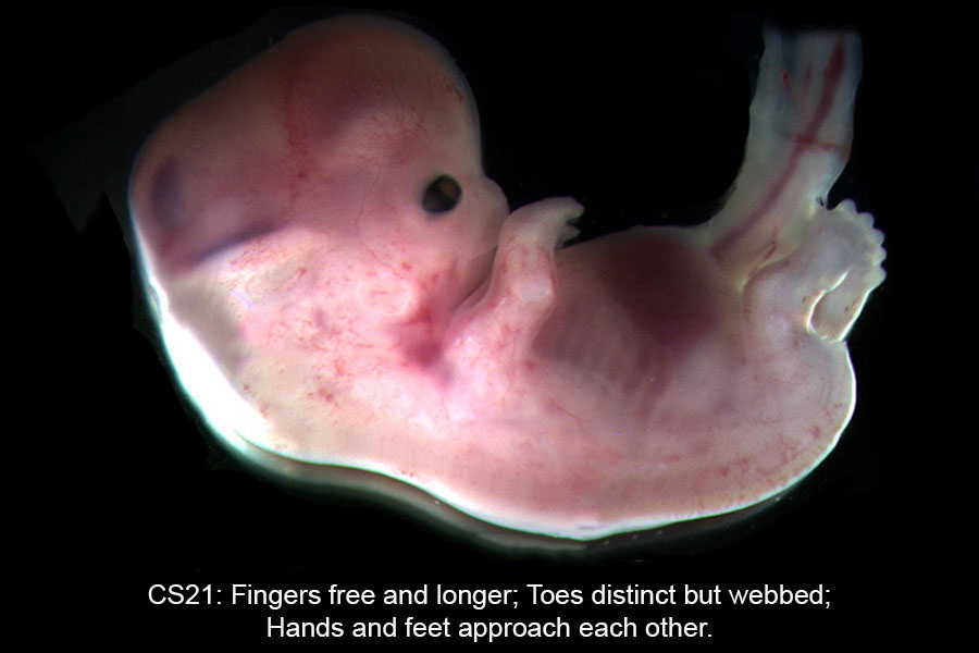 A human embryo, Carnegie Stage 21