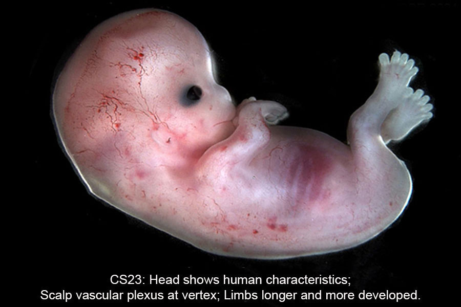 A human embryo, Carnegie Stage 23