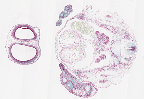 Ki67 RNAscope in a human embryo