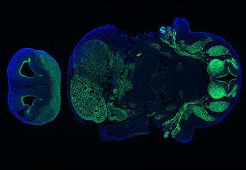 Immunofluorescence in a human embryo